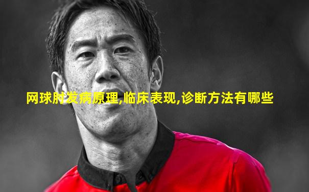 网球肘发病原理,临床表现,诊断方法有哪些
